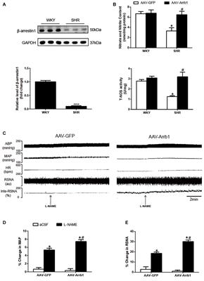 The Release of Nitric Oxide Is Involved in the β-Arrestin1-Induced Antihypertensive Effect in the Rostral Ventrolateral Medulla